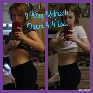 3DR Before and After